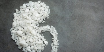 Vesekő és étrend – mit érdemes (és mit nem) enni, ha szeretné elkerülni?